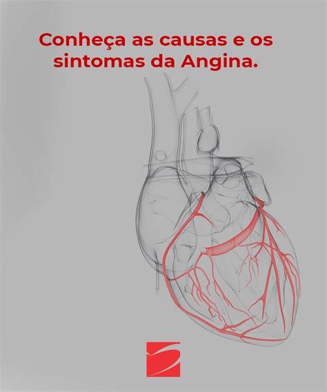 Entenda a ANGINA ICOR Instituto do Coração de Santa Maria