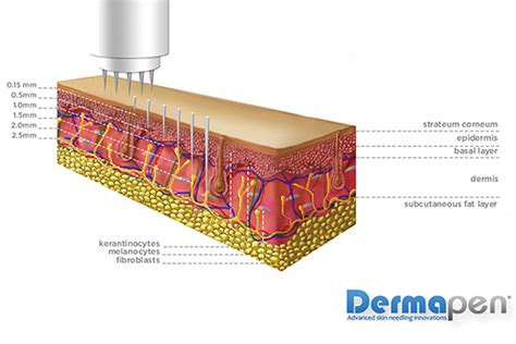 Dermapen - Micro-Needling Skin Therapy - Visona Beauty