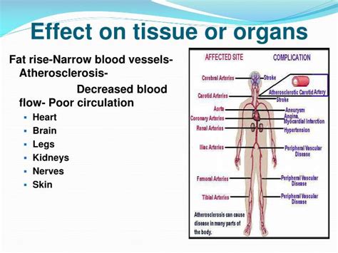 Ppt Dr Zhao Tcm Help Diabetes Powerpoint Presentation Id 4198816