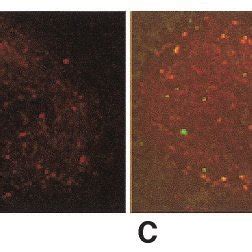 Dual Channel Fluorescence Microscopy Of The Frozen Pancreatic Section