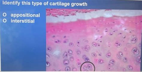 Solved Identify this type of cartilage growth appositional | Chegg.com