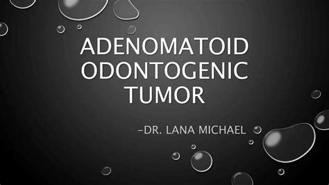 Adenomatoid Odontogenic Tumor Ppt