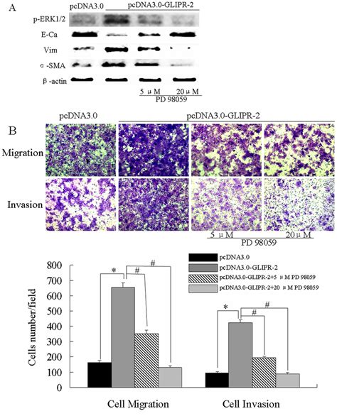 GLIPR 2 Induces The EMT Like Phenotype Following Enhanced Migration And