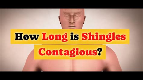 How Long Is Shingles Contagious Youtube