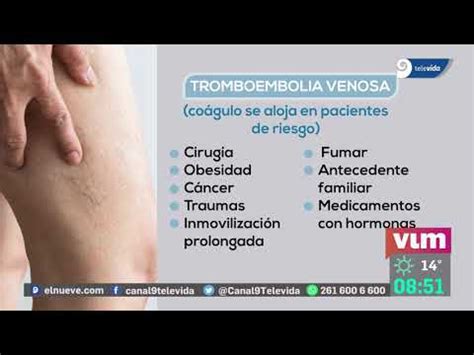 ¿cómo Podemos Prevenir Una Trombosis Youtube