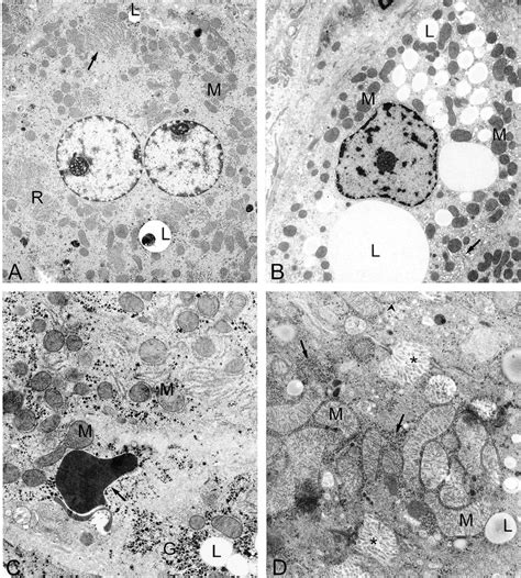 Electron Micrographs Of Rat Liver A Control Rat Binuclear Hepatocyte