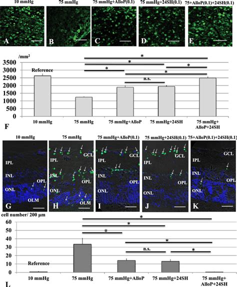 Rgc Survival Test And Visualization Of Apoptotic Cells By Fluorescence