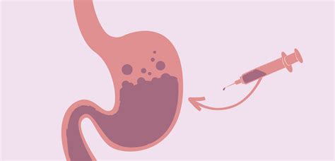 Combining Insulin and Amylin to Treat Type 1 Diabetes – BETTER