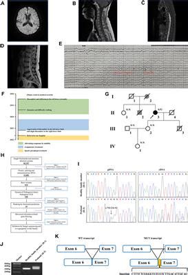 Frontiers Case Report A Novel Washc Variant Altering Mrna Splicing