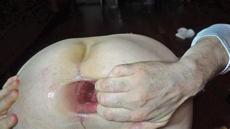 Fist And Monster Gaping Asshole Nude Pics XHamster