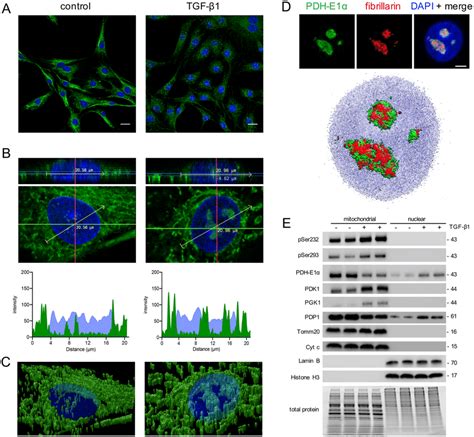 Effect of TGF β1 on the compartmentalisation of PDH in UUOF A