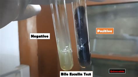 Bile Esculin Test: Introduction,Principle, Test Requirements, Procedure