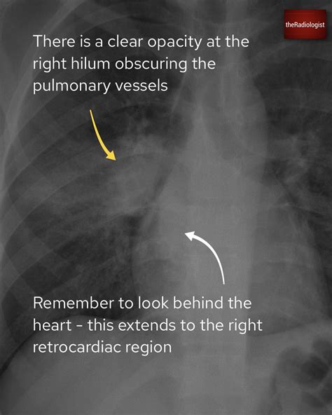 Theradiologist On Twitter Case Explanation