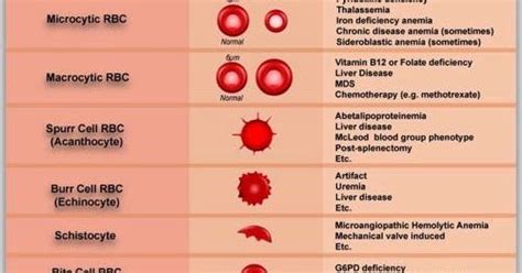 Abnormal Rbc Morphology Medschool Doctor Medicalstudent Image