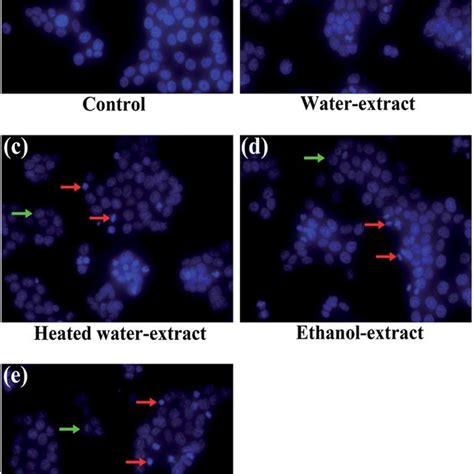 Morphological Features Of Hct Cells Treated By Cell Medium