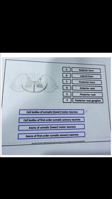 SOLVED: Anterior horn, Lateral horn, Posterior horn Anterior root ...