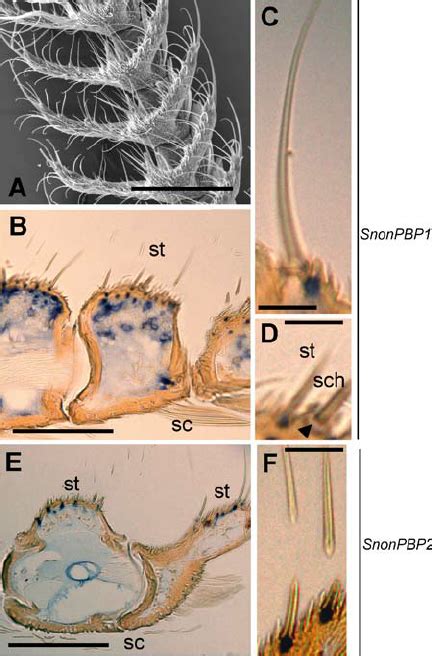 Expression Patterns Of Snonpbp And Snonpbp Revealed By In Situ