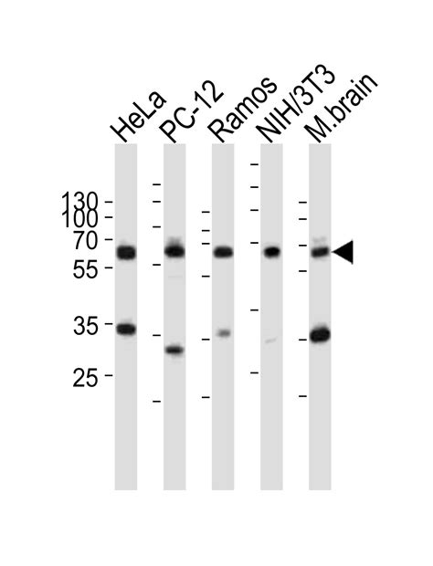 Pyruvate Kinase Antibody - Cat. No. 62-617 | ProSci