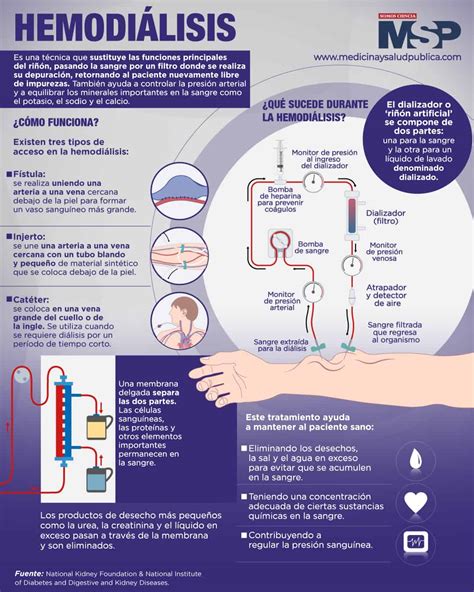 Hemodialisis Infografía