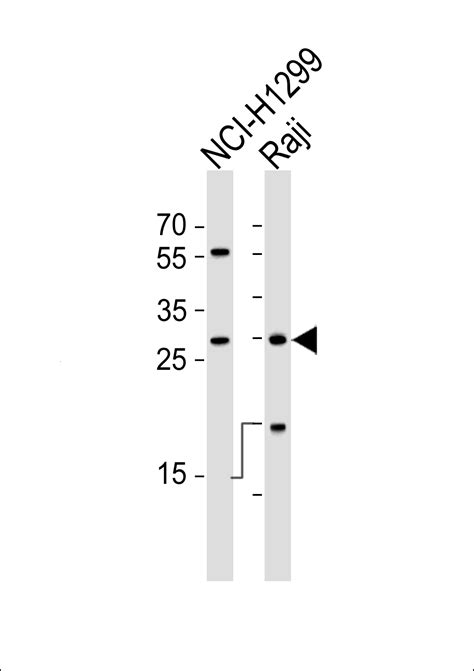 HLA DRB1 Antibody N Term Affinity Purified Rabbit Polyclonal