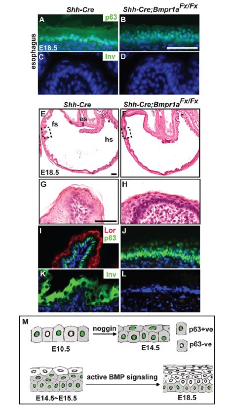 Deletion Of Bmpr1a Inhibits Differentiation Of The Esophageal And