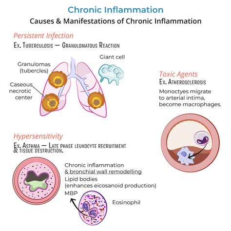 Immunology Microbiology Glossary Chronic Inflammation Ditki