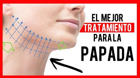 Lifting En La Papada Cl Nica Medicina Integrativa Youtube