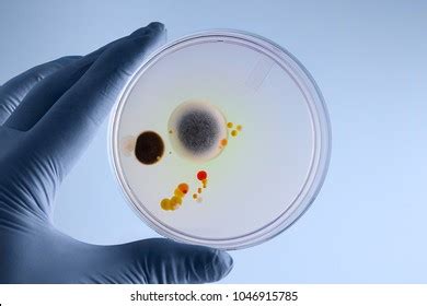 Hand Microbiologist Holding Petri Plate Growth Stock Photo