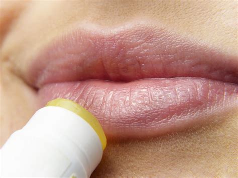 Herpes Labial S Ntomas Y Tratamiento Cl Nica Bajo