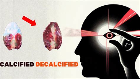 Ways To Decalcify Your Pineal Gland Youtube