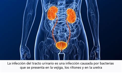 Infecci N Urinaria Durante El Embarazo Infogen