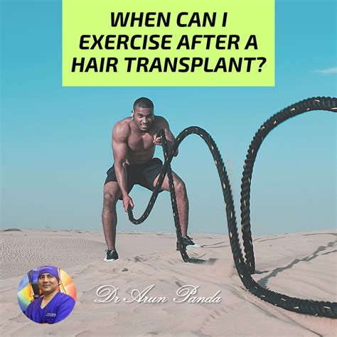 How Long After A Hair Transplant Can You Exercise