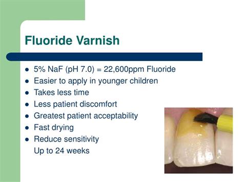 PPT - Topical Fluoride PowerPoint Presentation - ID:4432199