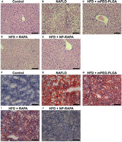 Frontiers Rapamycin Loaded Mpeg Plga Nanoparticles Ameliorate Hepatic