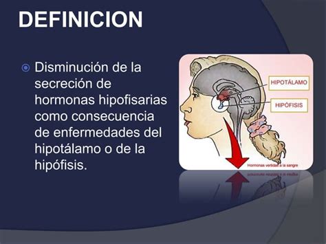 Hipopituitarismo Ppt