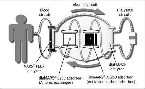 Extracorporeal Liver Support Albumin Dialysis With The Molecular