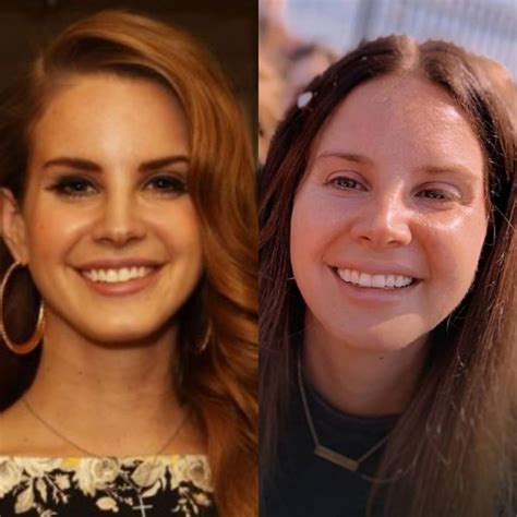 Lana Del Rey S Plastic Surgery A Comprehensive Analysis The Chupitos