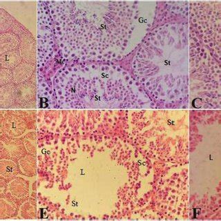 Histological Sections Of Testes In Male Mice Treated With Five Doses Of