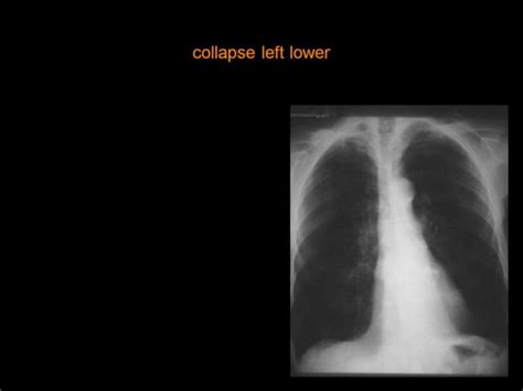 28 Dr Ahmed Esawy Imaging Oral Board Of Chest Imaging Variety Part