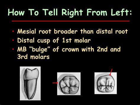 Ppt Permanent Molars Powerpoint Presentation Free Download Id 421601