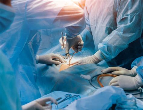 Process Of Gynecological Surgery Operation Using Laparoscopic Equipment