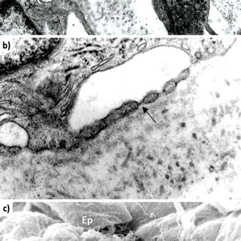 Electron micrographs of a tonsillar crypt epithelium: (a) Scanning ...