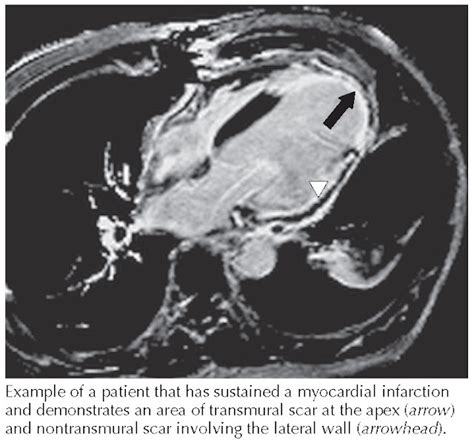 Cardiac Magnetic Resonance Imaging Pediagenosis