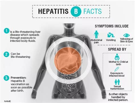 Hepatitis B Symptoms Diagnosis And Treatment Ailbs India