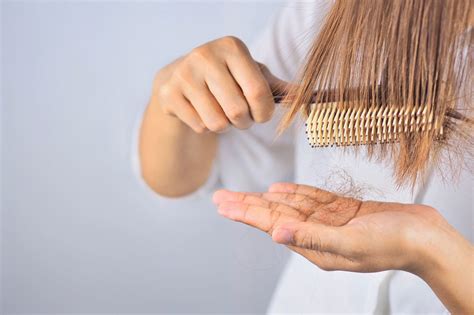 Caída del cabello Causas y tratamientos Clínica Ciudad del Mar