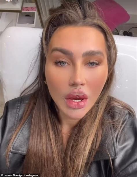 Lauren Goodger Shows Off Her New Lips After Butterfly Effect Filler