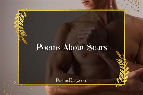 3 Poems About Scars That Are Nothing To Be Ashamed About — Poems Easy