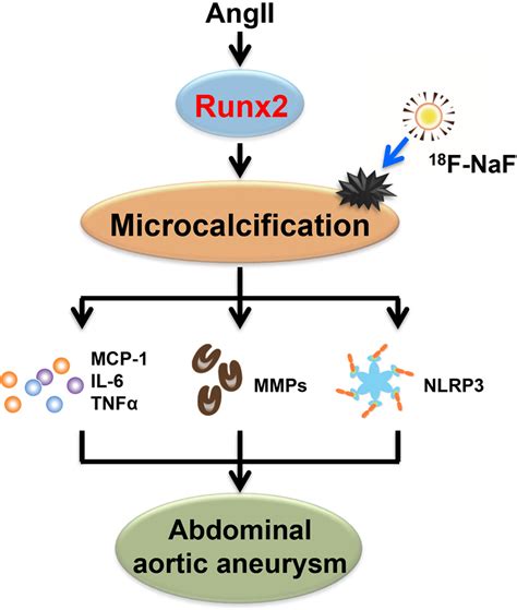 Runx2 Runt Related Transcription Factor 2 Mediated Microcalcification