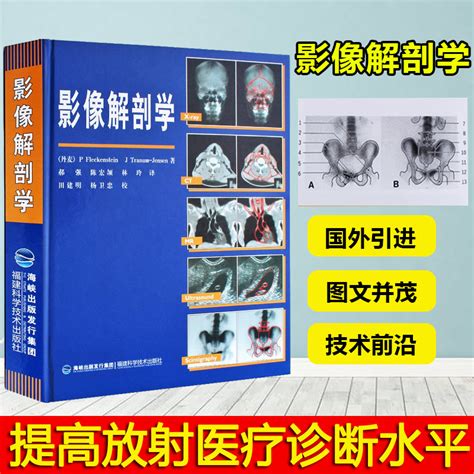 【正品】影像解剖学 X线ct磁共振mri 声诊断医学超声影像学诊断原理与技术图谱图解影像解剖学临床解剖学图谱影像学医学书籍 虎窝淘