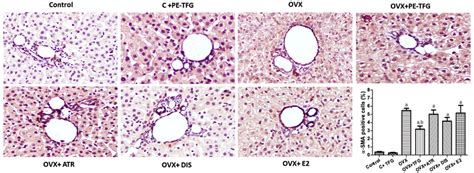 Immunohistochemistry of α smooth muscle actin αSMA in Download